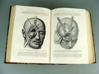 1935 GERMAN MEDICAL SURGICAL FACE BRAIN SKULL SPINE SPINAL CORD ART 